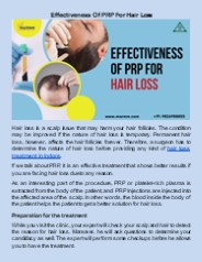 Effectiveness Of PRP For Hair Loss