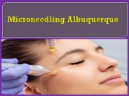 Microneedling Albuquerque