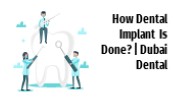 How Do Dental Implants Work? | Dental Dubai