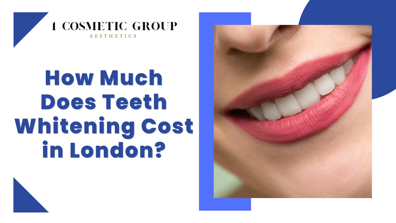 PPT How Much Does Teeth Whitening Cost in London? PowerPoint presentation free to download