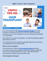 Useful Tips On Hair Transplant