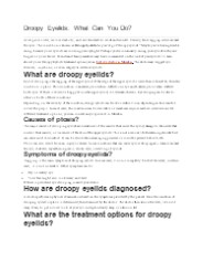 Droopy Eyelids: What Can You Do?