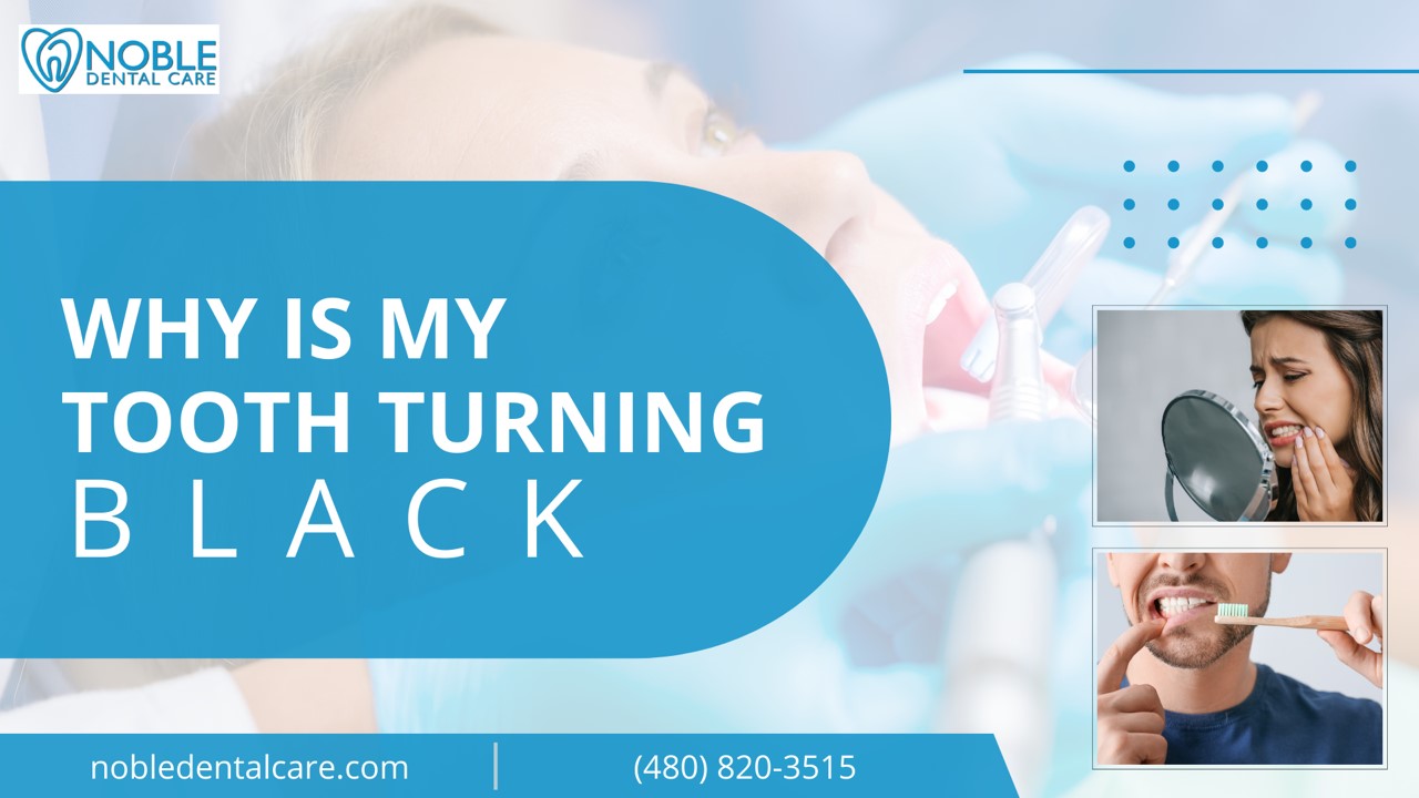 PPT Why is My Tooth Turning Black PowerPoint presentation free to download id 95cbb3MTdlY