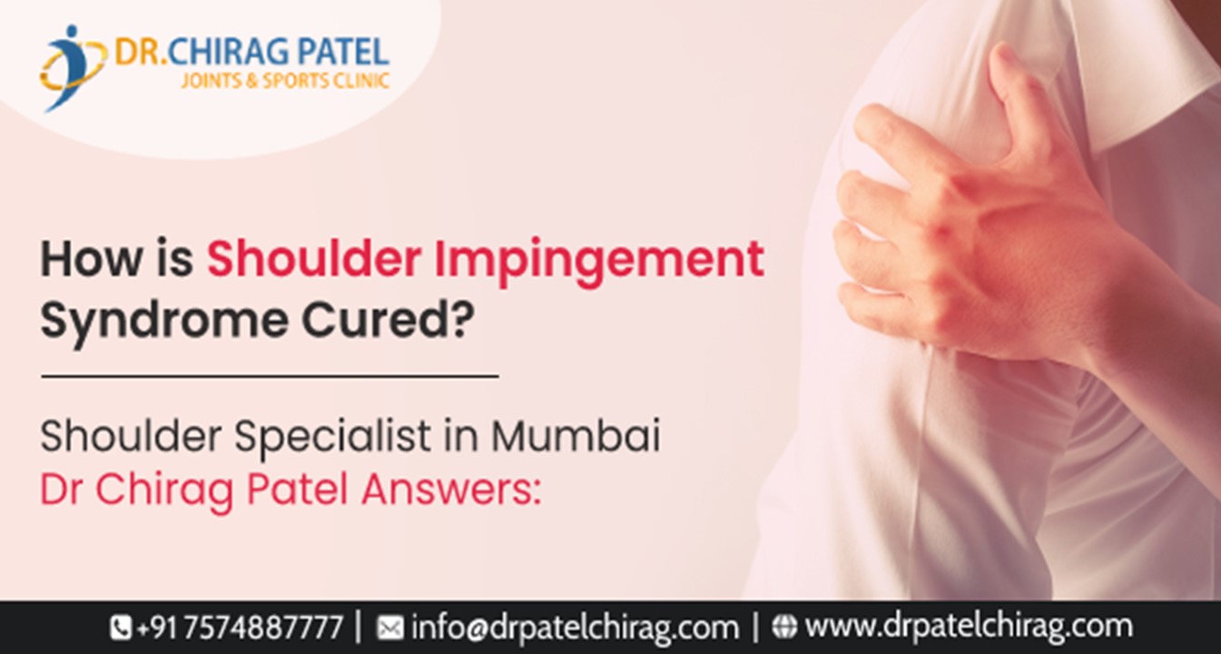 PPT Shoulder Impingement Syndrome Symptoms & Diagnosis PowerPoint