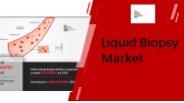Liquid Biopsy Market Share