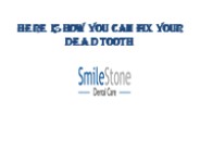 Here Is How You Can Fix Your Dead Tooth