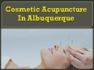 Cosmetic  Acupuncture In  Albuquerque