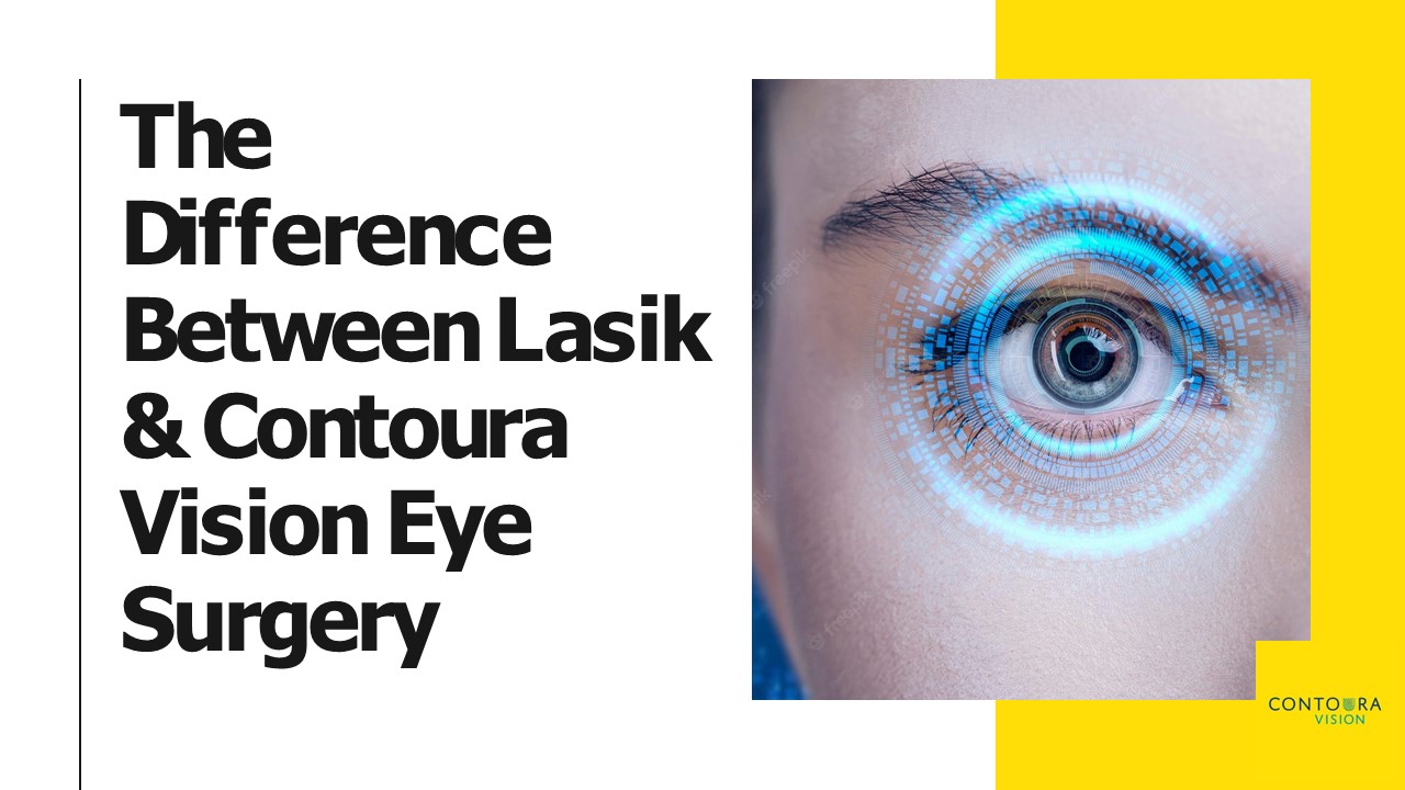 Difference Between Lasik and Contoura Vision