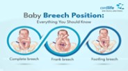 Baby Breech Position: Everything You Should Know