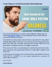 These Reasons Do Not Cause Male Pattern Baldness