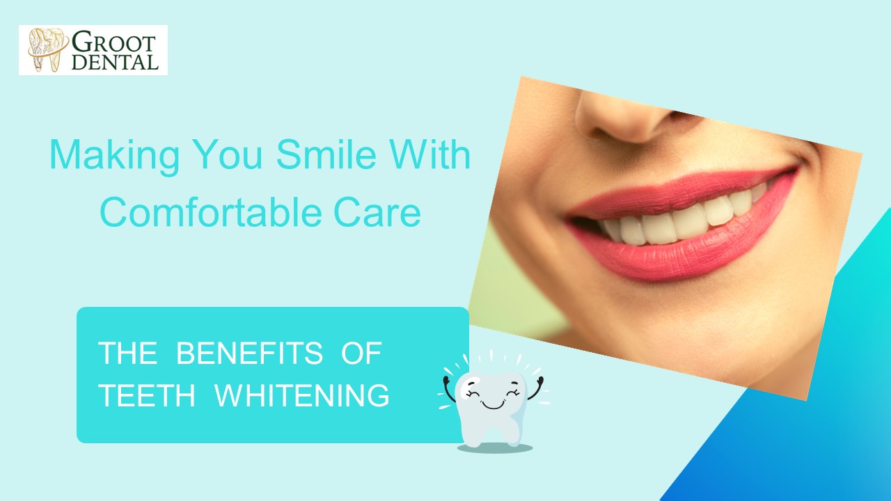 THE BENEFITS OF TEETH WHITENING - Groot Dental