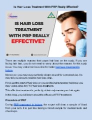 Is Hair Loss Treatment With PRP Really Effective?
