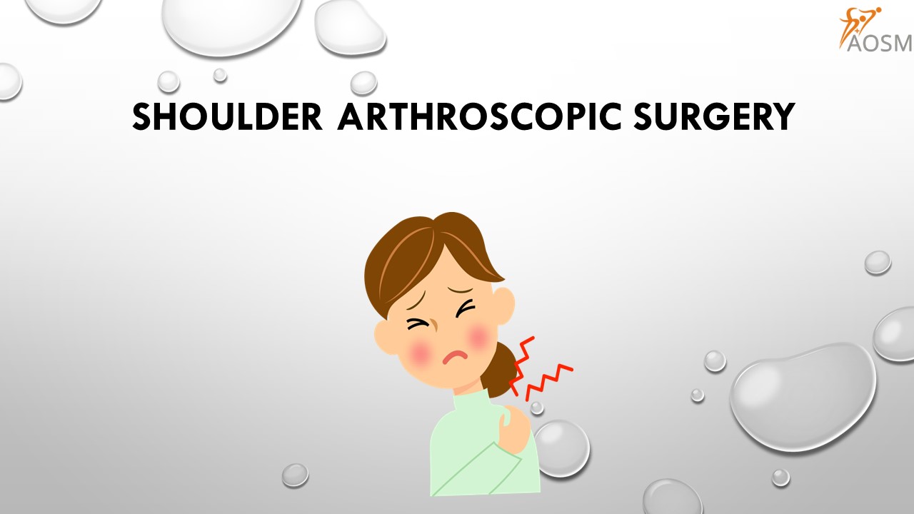 Shoulder Arthroscopic Surgery
