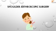 Shoulder Arthroscopic Surgery