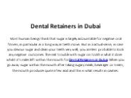 Best Dental Retainers in Dubai
