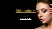 Rhinoplasty in Saudi Arabia