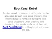 Root Canal Dubai