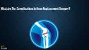 What Are The Complications In Knee Replacement Surgery?