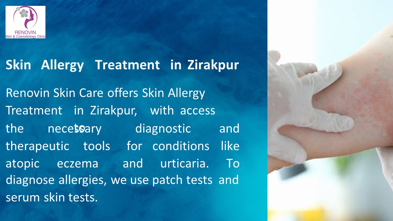 Fungal Infection Specialist Near Me