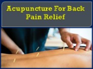 Acupuncture For Back Pain Relief (1)