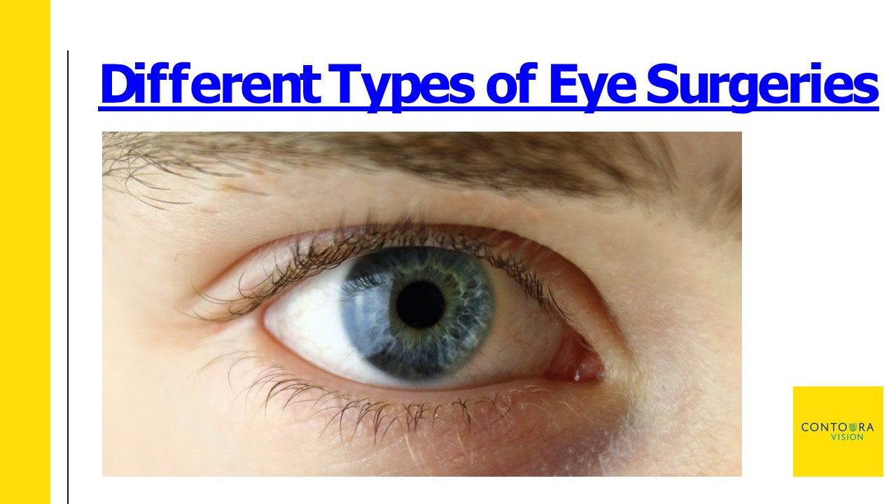 PPT Different Types of Eye Surgeries PowerPoint presentation free