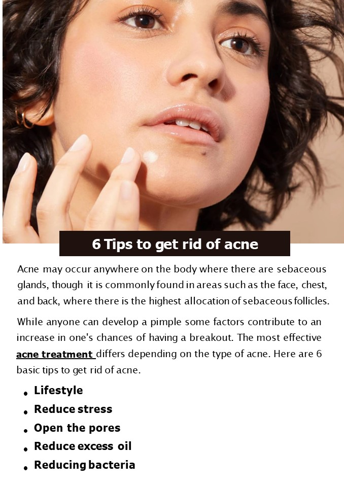 6 Tips to get rid of acne