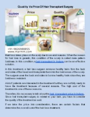 ​Quality Vs Price Of Hair Transplant Surgery
