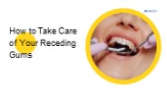 How to Take Care of Your Receding Gums