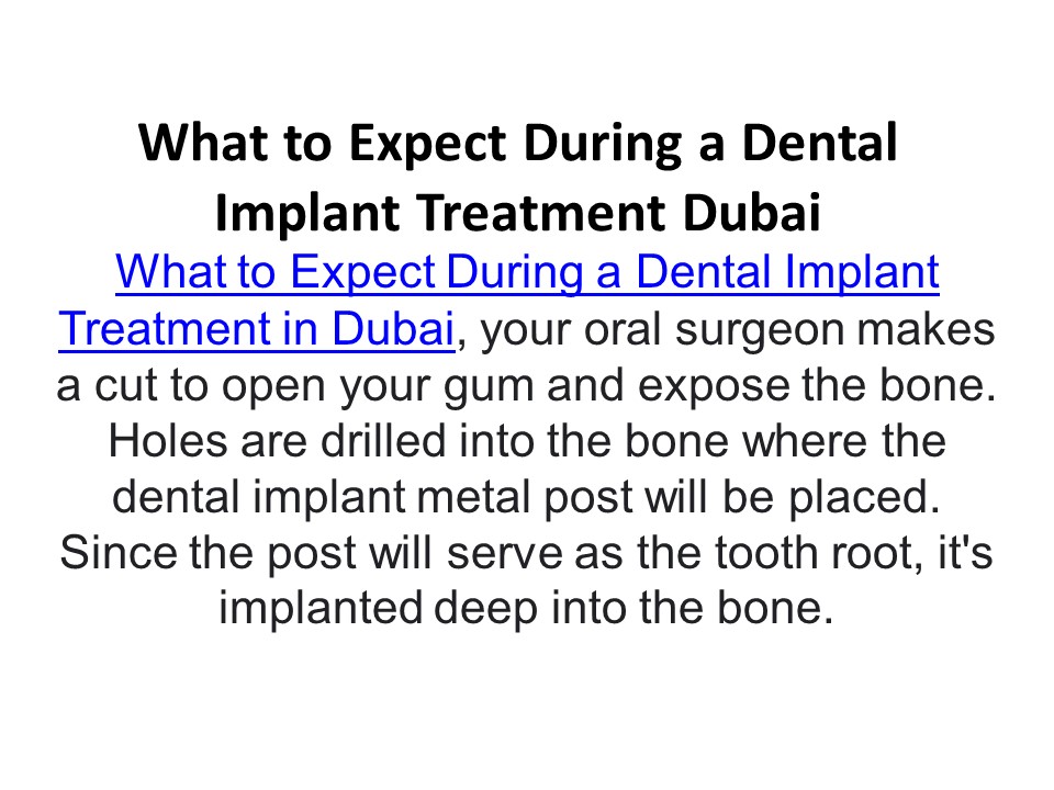 What to Expect During a Dental Implant Treatment in Dubai