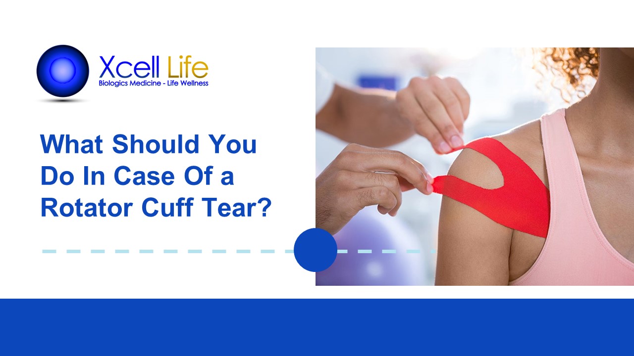 PPT What Should You Do In Case Of a Rotator Cuff Tear? PowerPoint presentation free to