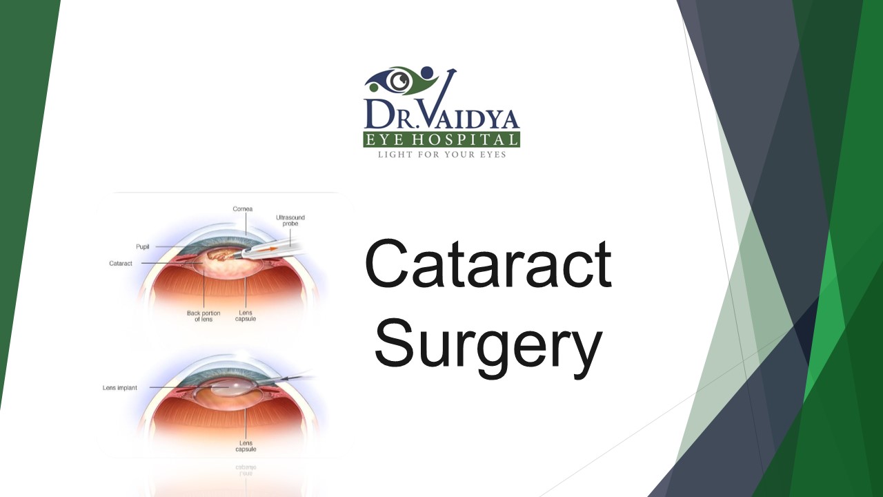 Cataract Surgery_Dr. Vaidya Eye Hospital