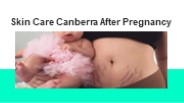 Skin Care Canberra After Pregnancy