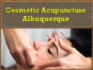 Cosmetic  Acupuncture Albuquerque