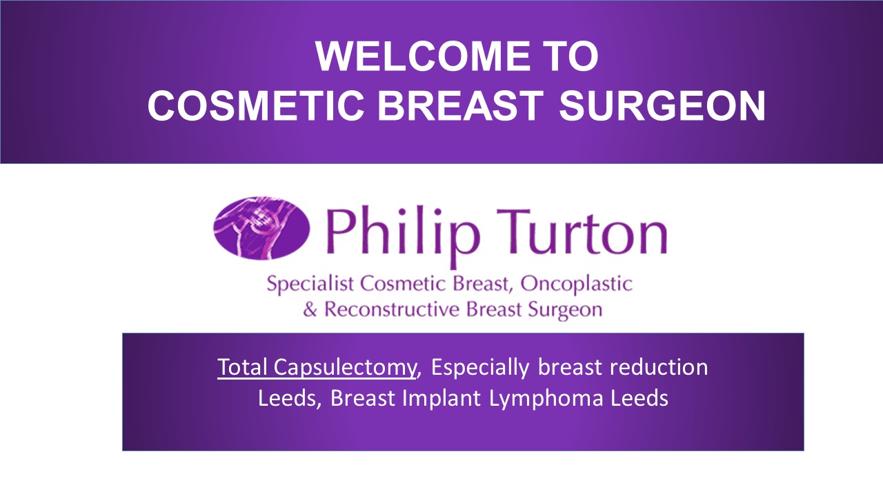 Total Capsulectomy, Especially breast reduction & Implant Lymphoma in Leeds
