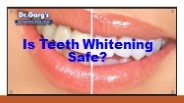 Is Teeth Whitening Safe?