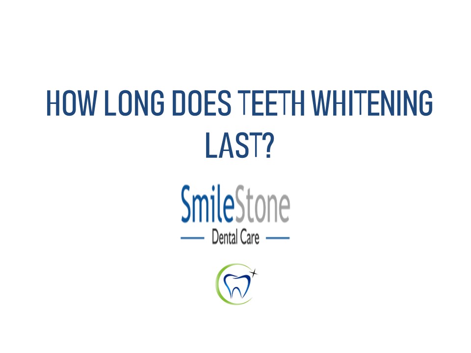 How long does teeth whitening last?