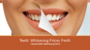Teeth Whitening Solutions Perth