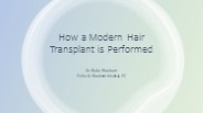 How a Modern Hair Transplant is Performed
