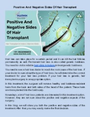 Positive And Negative Sides Of Hair Transplant