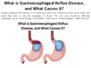 What exactly causes gastroesophageal reflux disease?