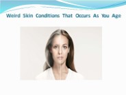 Weird Skin Conditions That Occurs As You Age (1)