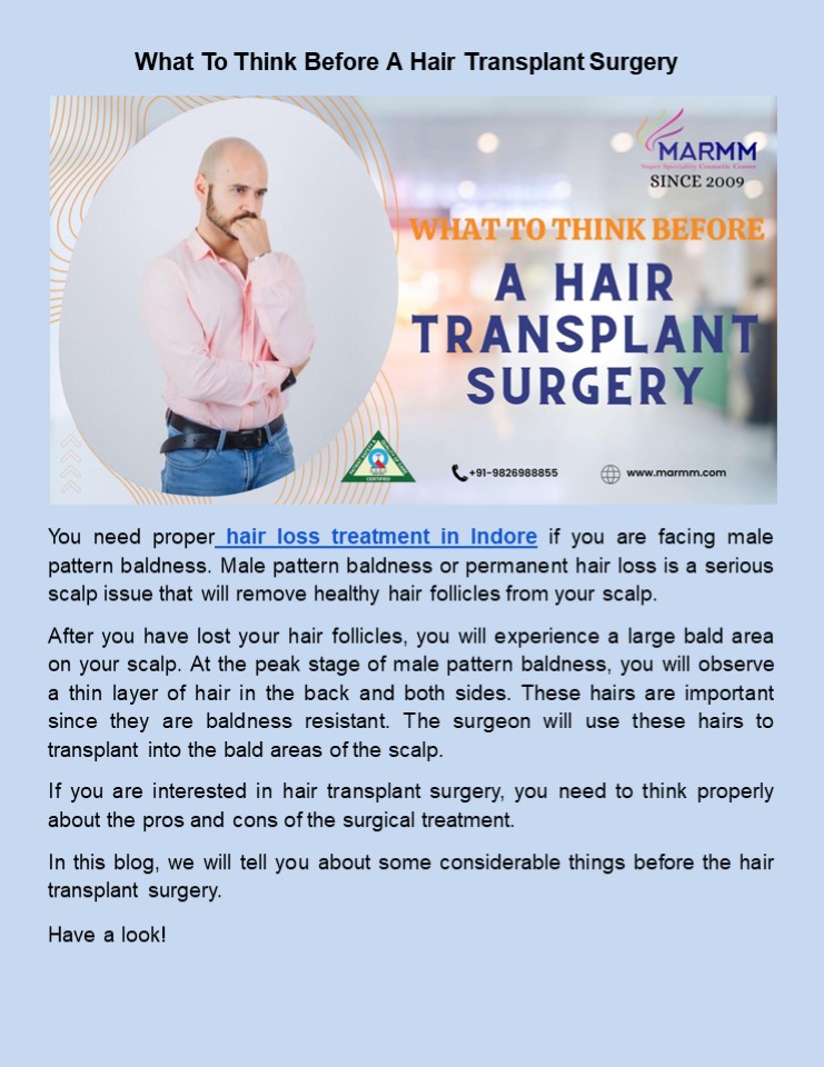 What To Think Before A Hair Transplant Surgery