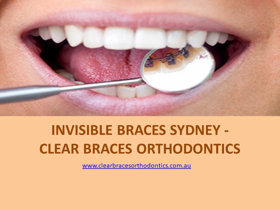 PPT Invisible Braces Sydney Clear Braces Orthodontics PowerPoint