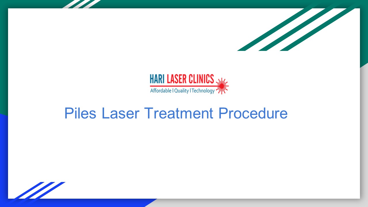 PPT Piles Laser treatment procedure PowerPoint presentation free to