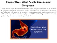 What Signs and Symptoms Indicate a Peptic Ulcer?