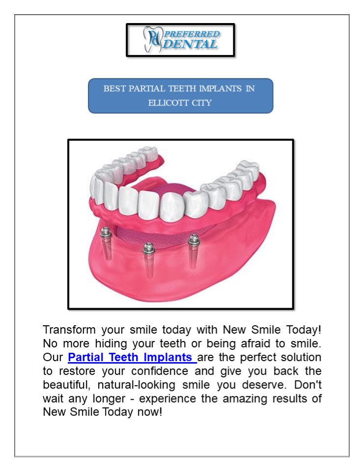 Best Partial Teeth Implants In Ellicott City