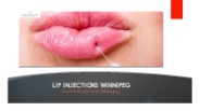 Lip Injections Winnipeg - Simply Radiant Aesthetics