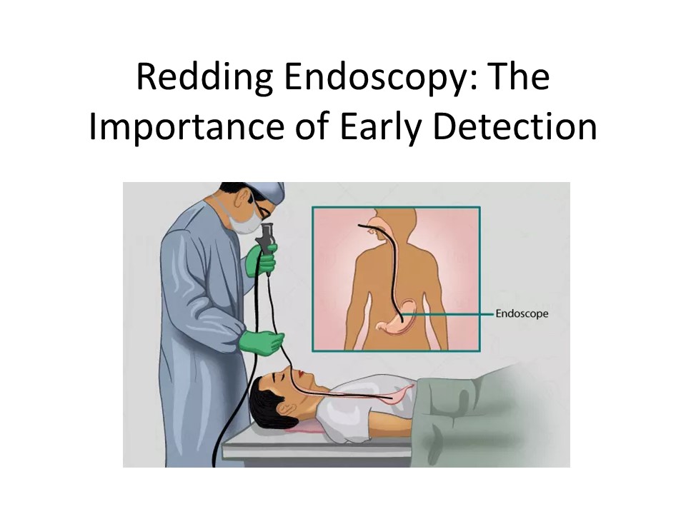 PPT Redding Endoscopy Center The Top Choice for Safe and Effective