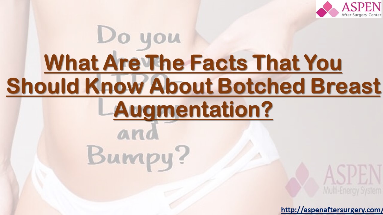 What Are The Facts That You Should Know About Botched Breast Augmentation?