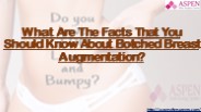 What Are The Facts That You Should Know About Botched Breast Augmentation?